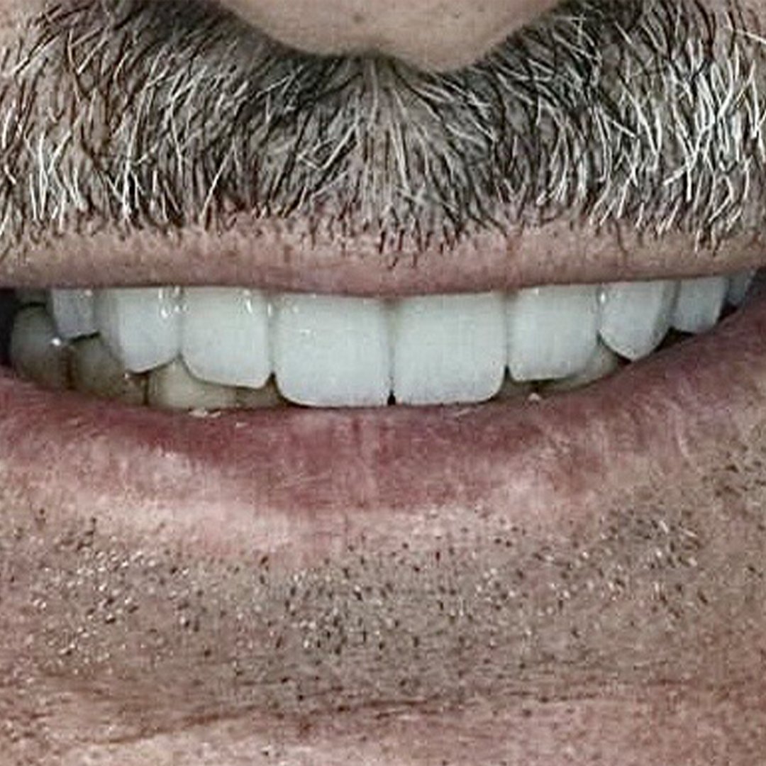 بعد — د. وهبي زرزور